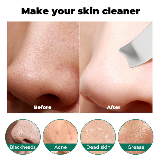 PureSkin™ Facial Cleaner