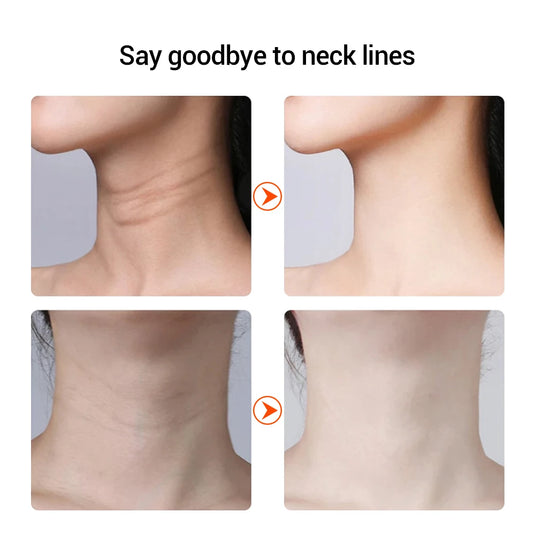 NeckRenew™